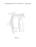 SYSTEMS AND METHODS FOR PROVIDING A FEMORAL COMPONENT diagram and image