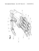 PROSTHETIC HAND SYSTEM diagram and image