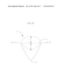 GASTRIC IMPLANT AND METHOD FOR USE OF SAME diagram and image