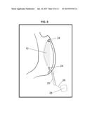 GASTRIC IMPLANT AND METHOD FOR USE OF SAME diagram and image