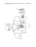 SHOULDER STABILIZATION APPARATUS AND METHODS diagram and image