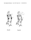 Interface for Adjusting the Motion of a Powered Orthotic Device through     Externally Applied Forces diagram and image