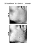 SKIN ENHANCING BEVERAGE COMPOSITION diagram and image