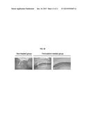 PHARMACEUTICAL COMPOSITION FOR PROTECTING WOUNDS, PROVIDING HEMOSTASIS, OR     PREVENTING ADHESION IN THE GASTROINTESTINAL TRACT diagram and image