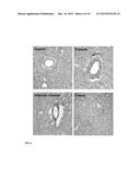 USE OF NK-1 RECEPTOR ANTAGONISTS FOR TREATING HYPOMAGNESEMIA, NEUROGENIC     INFLAMMATION, AND CARDIAC DYSFUNCTION ASSOCIATED WITH EGFR-BLOCKING DRUGS diagram and image