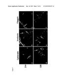 Wound Dressing Nanomesh Impregnated with Human Umbilical Cord Wharton s     Jelly Stem Cells diagram and image