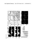 Wound Dressing Nanomesh Impregnated with Human Umbilical Cord Wharton s     Jelly Stem Cells diagram and image