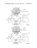 OCCLUSION SENSING FOR AN INFUSION PUMP diagram and image