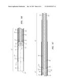 DEFLECTABLE CATHETER SHAFT SECTION diagram and image