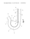 Variable Curvature Catheter diagram and image