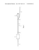 CATHETER WITH ADJUSTABLE GUIDEWIRE EXIT POSITION diagram and image