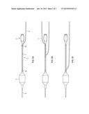 CATHETER WITH ADJUSTABLE GUIDEWIRE EXIT POSITION diagram and image