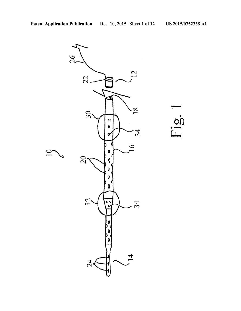 DEVICES, SYSTEMS, AND METHODS FOR AUTO-RETROPERFUSION OF THE CEREBRAL     VENOUS SYSTEM - diagram, schematic, and image 02