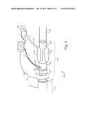 DEVICES, SYSTEMS, AND METHODS FOR AUTO-RETROPERFUSION OF THE CEREBRAL     VENOUS SYSTEM diagram and image