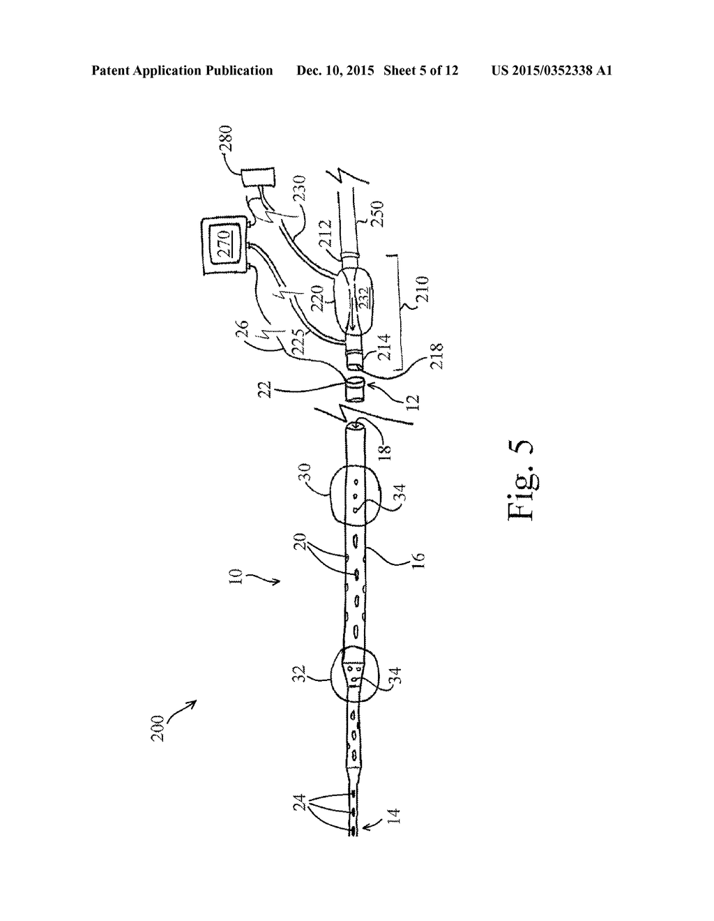 DEVICES, SYSTEMS, AND METHODS FOR AUTO-RETROPERFUSION OF THE CEREBRAL     VENOUS SYSTEM - diagram, schematic, and image 06