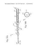 DEVICES, SYSTEMS, AND METHODS FOR AUTO-RETROPERFUSION OF THE CEREBRAL     VENOUS SYSTEM diagram and image