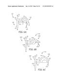 TINE FIXATION COMPONENTS FOR IMPLANTABLE MEDICAL DEVICES diagram and image