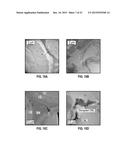 MULTI-LIGAND METAL COMPLEXES AND METHODS OF USING SAME TO PERFORM     OXIDATIVE CATALYTIC PRETREATMENT OF LIGNOCELLULOSIC BIOMASS diagram and image