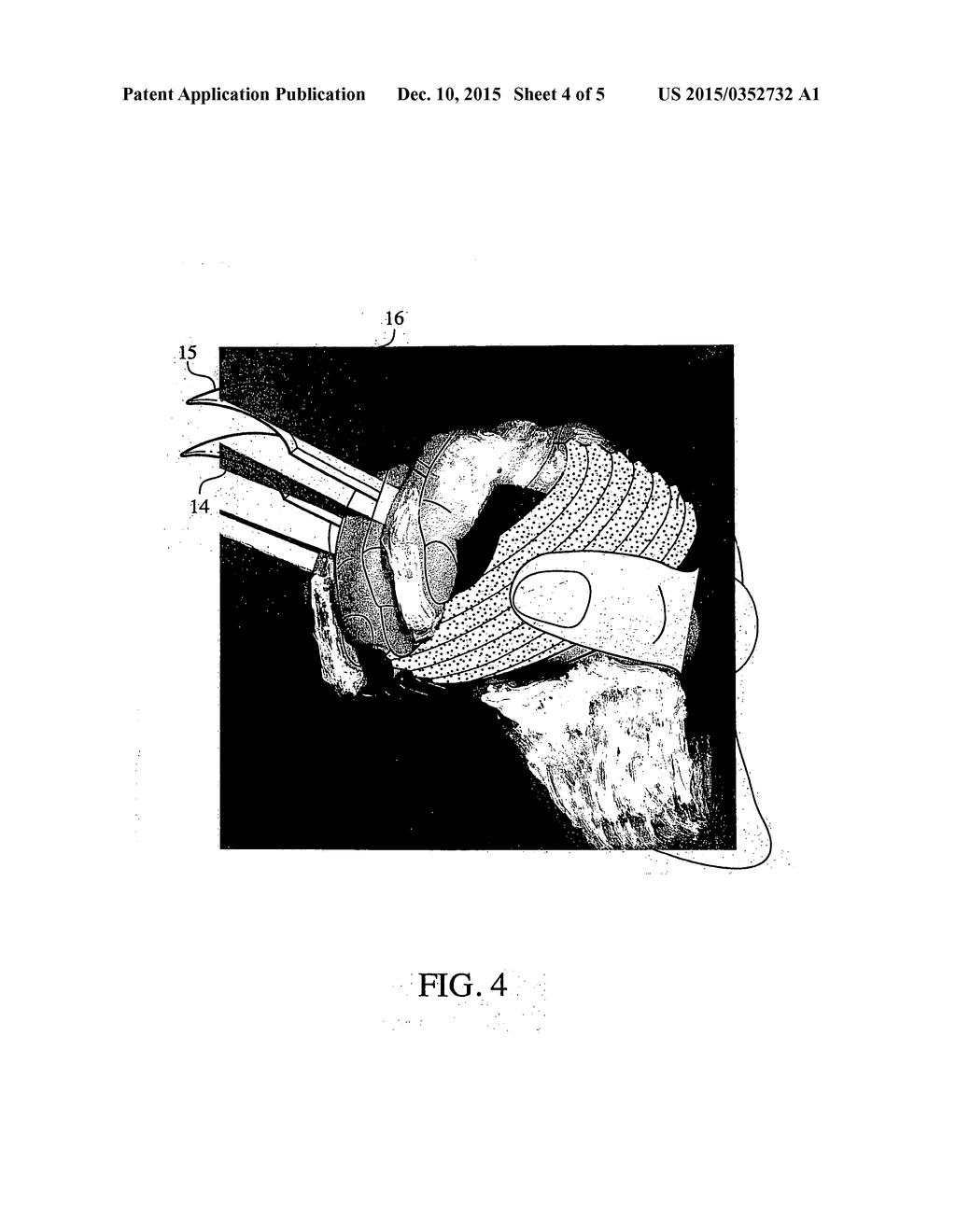 Protective weapon - diagram, schematic, and image 05