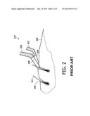 CUTTING UNIT WITH GUARD TEETH AND HAIR-CUTTING DEVICE diagram and image