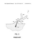 CUTTING UNIT WITH GUARD TEETH AND HAIR-CUTTING DEVICE diagram and image