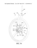 FLEXIBLE MEMBERS AND FLEXIBLE MEMBER ATTACHMENT POCKETS FOR A VEHICLE     SUSPENSION SYSTEM diagram and image