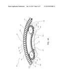 APPARATUS FOR ASSISTING THE MOVEMENT OF A CHAIN diagram and image