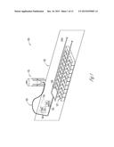 ACCELEROMETER-BASED SYSTEM FOR MONITORING FLOW diagram and image