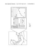 ACCELEROMETER-BASED SYSTEM FOR MONITORING FLOW diagram and image