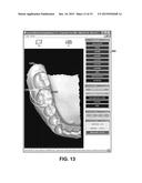 Dental Occlusion Analysis Tool diagram and image