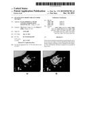 QUANTITATIVE PREDICTORS OF TUMOR SEVERITY diagram and image