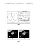 QUANTITATIVE PREDICTORS OF TUMOR SEVERITY diagram and image