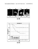 QUANTITATIVE PREDICTORS OF TUMOR SEVERITY diagram and image