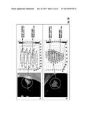 QUANTITATIVE PREDICTORS OF TUMOR SEVERITY diagram and image