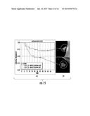 QUANTITATIVE PREDICTORS OF TUMOR SEVERITY diagram and image