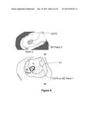 COMPUTER IMPLEMENTED METHODS FOR IDENTIFYING CHANNELS IN A 3D VOLUME AND     COMPUTER PROGRAM PRODUCT IMPLEMENTING THE METHODS diagram and image