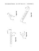 TREMOLO DEVICE diagram and image