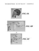 MODULAR ANTENNA FOR IMPLANTABLE MEDICAL DEVICE diagram and image