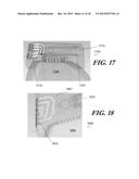 MODULAR ANTENNA FOR IMPLANTABLE MEDICAL DEVICE diagram and image