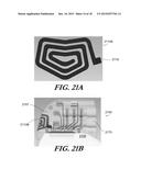 MODULAR ANTENNA FOR IMPLANTABLE MEDICAL DEVICE diagram and image