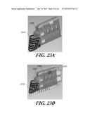 MODULAR ANTENNA FOR IMPLANTABLE MEDICAL DEVICE diagram and image