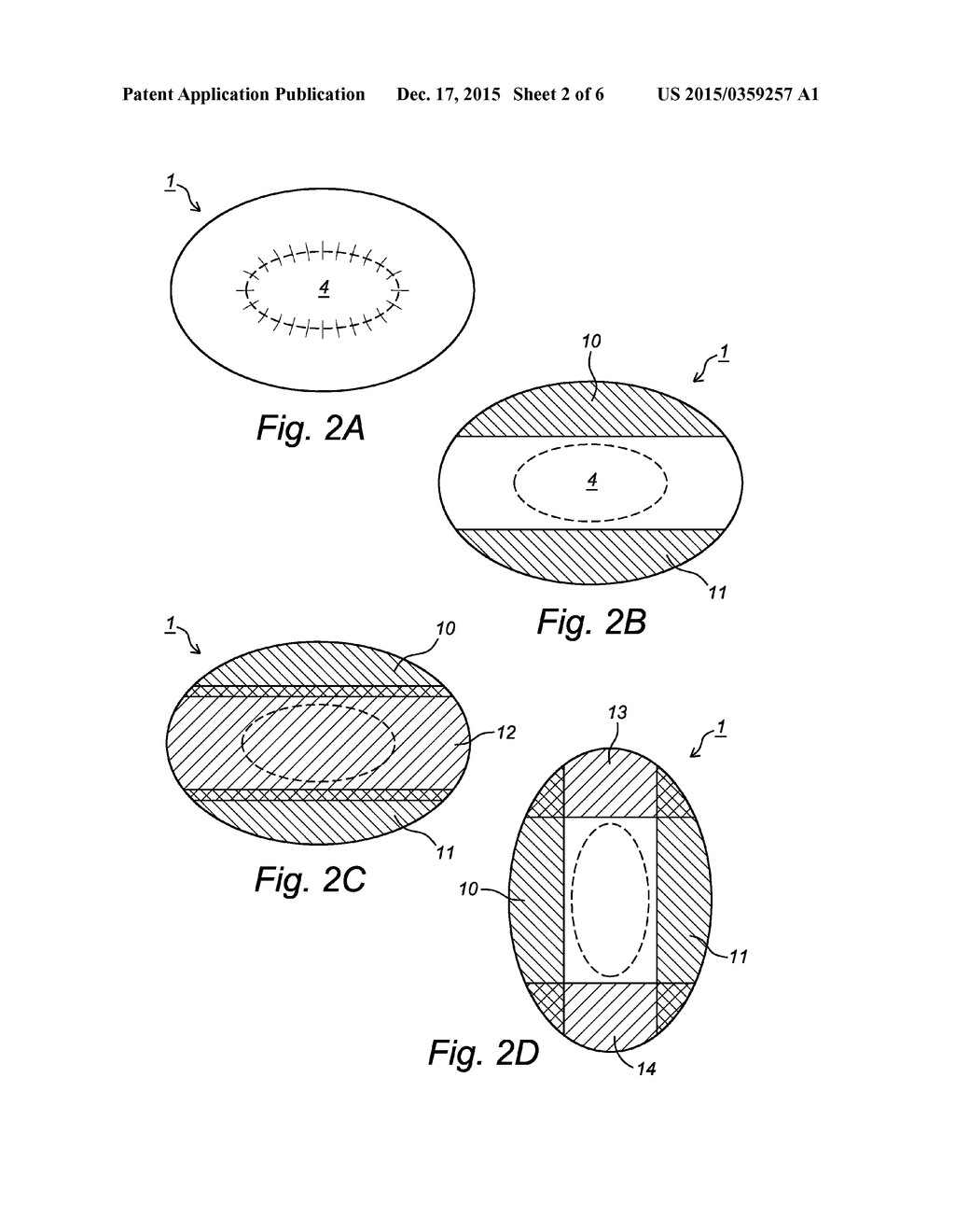 DEVICE AND METHOD FOR PROCESSING LAYERED FOOD PRODUCTS - diagram, schematic, and image 03