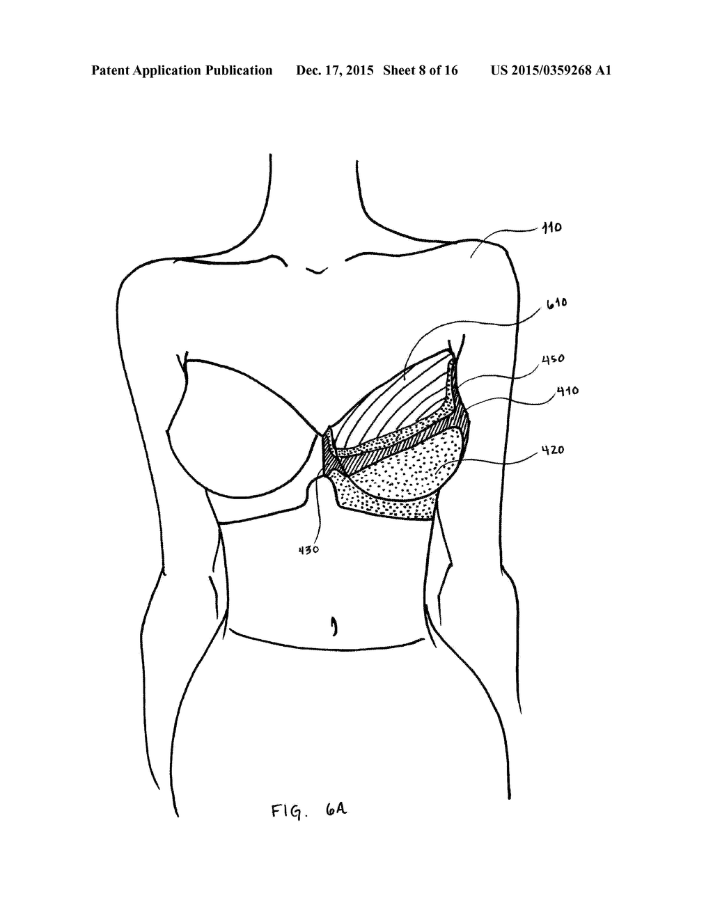 SUPPORT BUSTIER GARMENT - diagram, schematic, and image 09