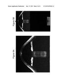 Procedural Optical Coherence Tomography (OCT) for Surgery and Related     Methods diagram and image