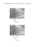 FIBER OPTIC SHAPE SENSING APPLICATIONS diagram and image