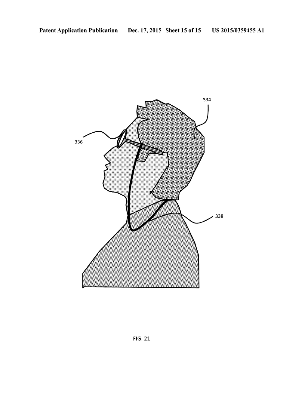 FIBER OPTIC SHAPE SENSING APPLICATIONS - diagram, schematic, and image 16