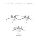 SYNTHETIC APERTURE ULTRASOUND SYSTEM diagram and image