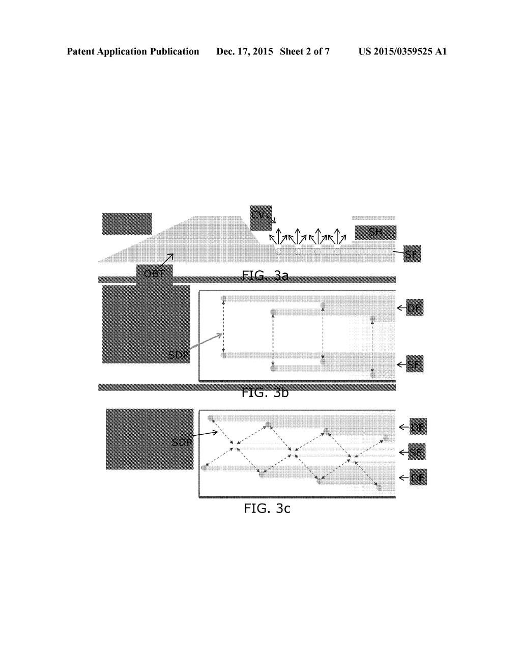 Optical guided vacuum assisted biopsy device - diagram, schematic, and image 03