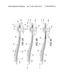 MINIMALLY INVASIVE SURGICAL SUTURING DEVICE FOR PAPILLARY MUSCLES AND     METHODS THEREOF diagram and image