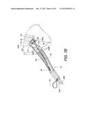 MINIMALLY INVASIVE SURGICAL SUTURING DEVICE FOR PAPILLARY MUSCLES AND     METHODS THEREOF diagram and image